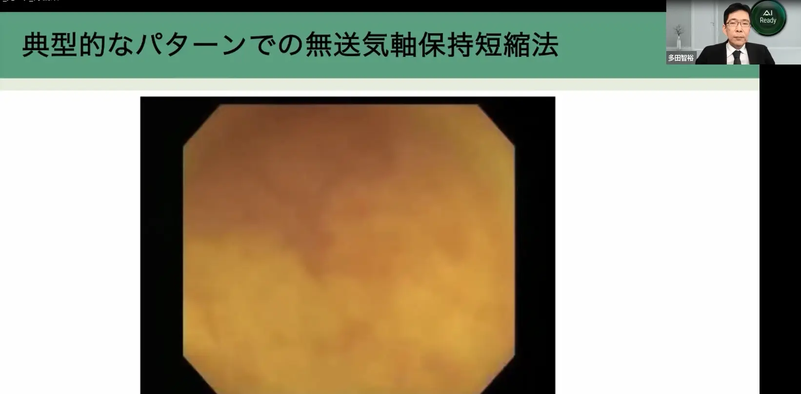 ポイント①”無送気軸保持短縮法”のコツが分かる