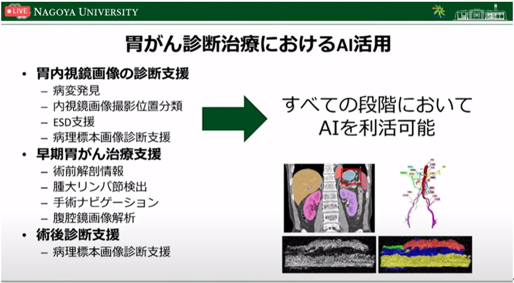 胃がん診断・治療のすべての段階でAI利活用の可能性を探る!名古屋大学大学院・森健策教授による最新研究の紹介(第94回日本胃癌学会総会)