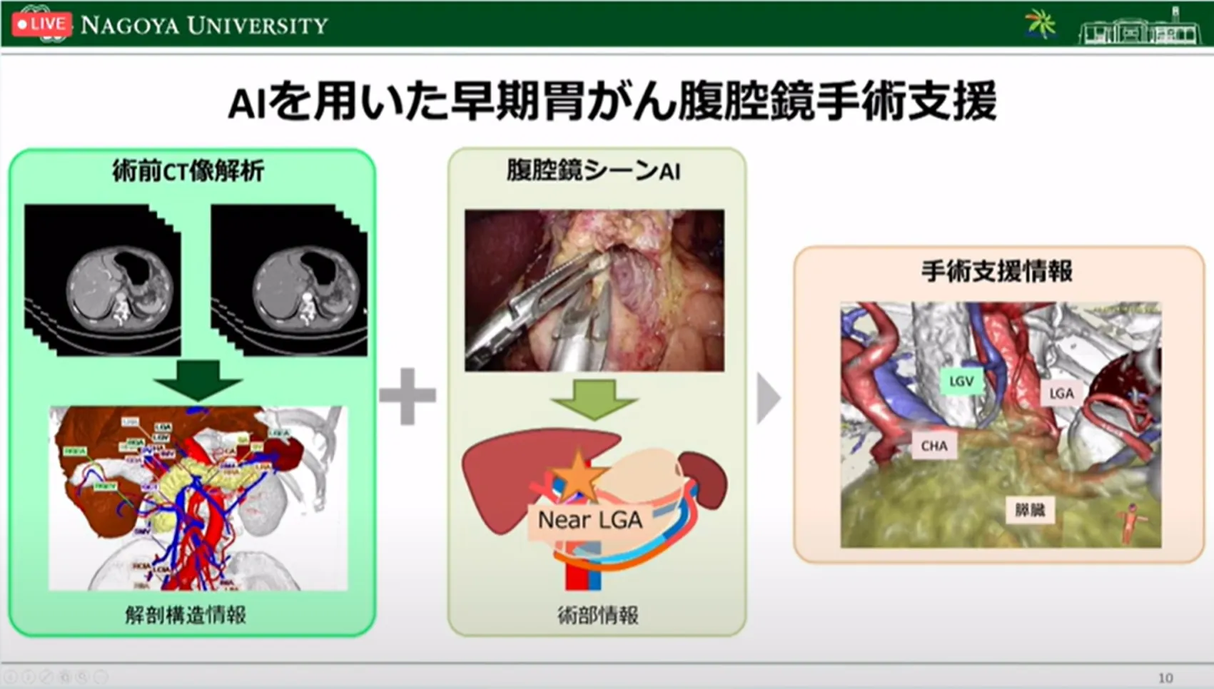 胃がん診断・治療のすべての段階でAI利活用の可能性を探る!名古屋大学大学院・森健策教授による最新研究の紹介(第94回日本胃癌学会総会)