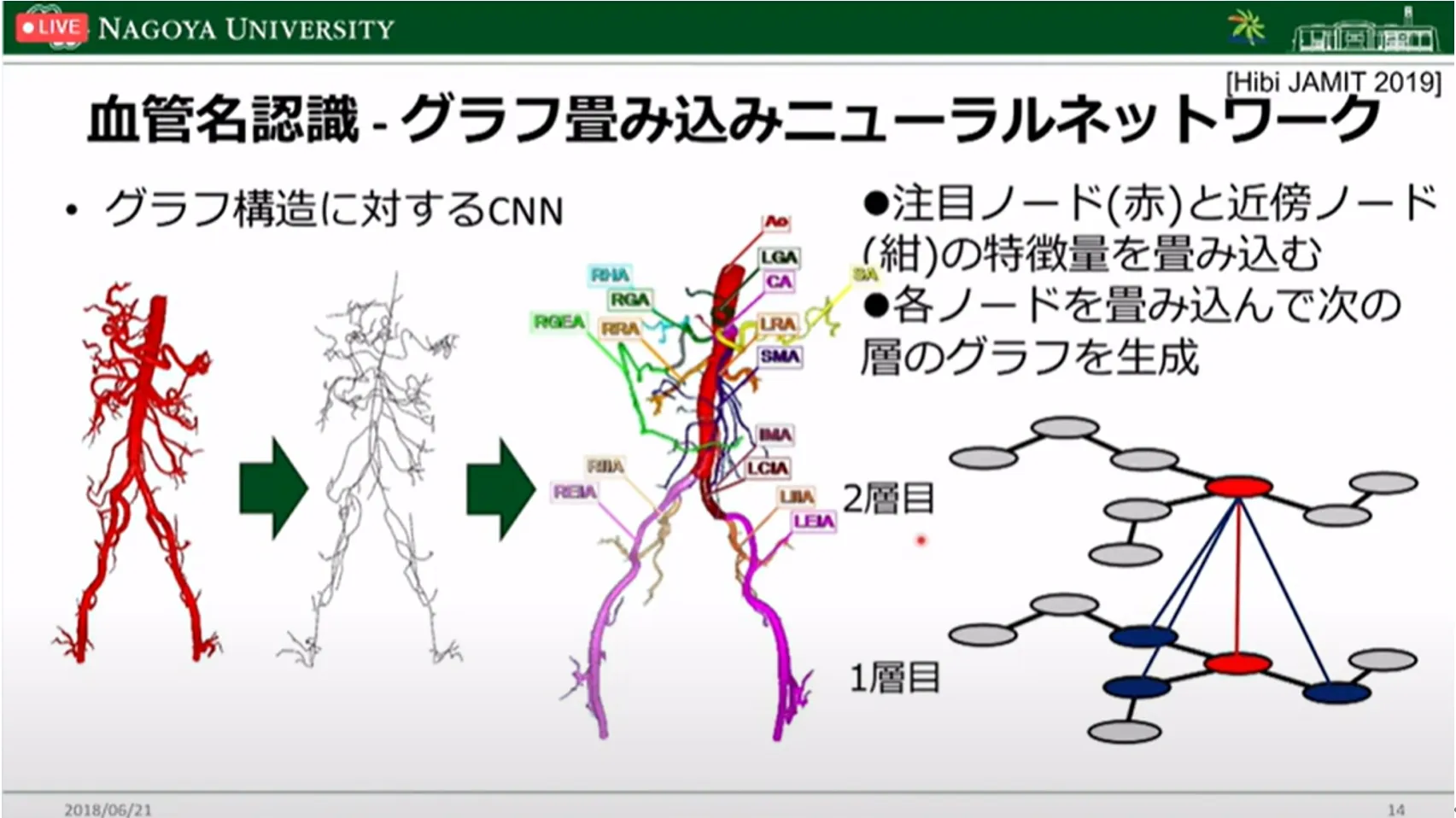 胃がん診断・治療のすべての段階でAI利活用の可能性を探る!名古屋大学大学院・森健策教授による最新研究の紹介(第94回日本胃癌学会総会)
