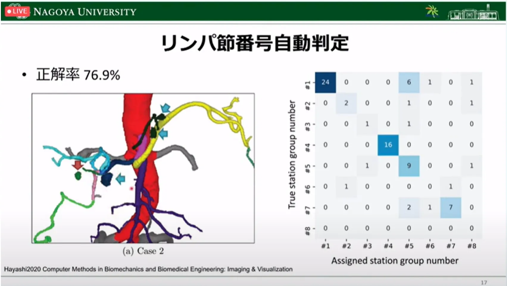 胃がん診断・治療のすべての段階でAI利活用の可能性を探る!名古屋大学大学院・森健策教授による最新研究の紹介(第94回日本胃癌学会総会)