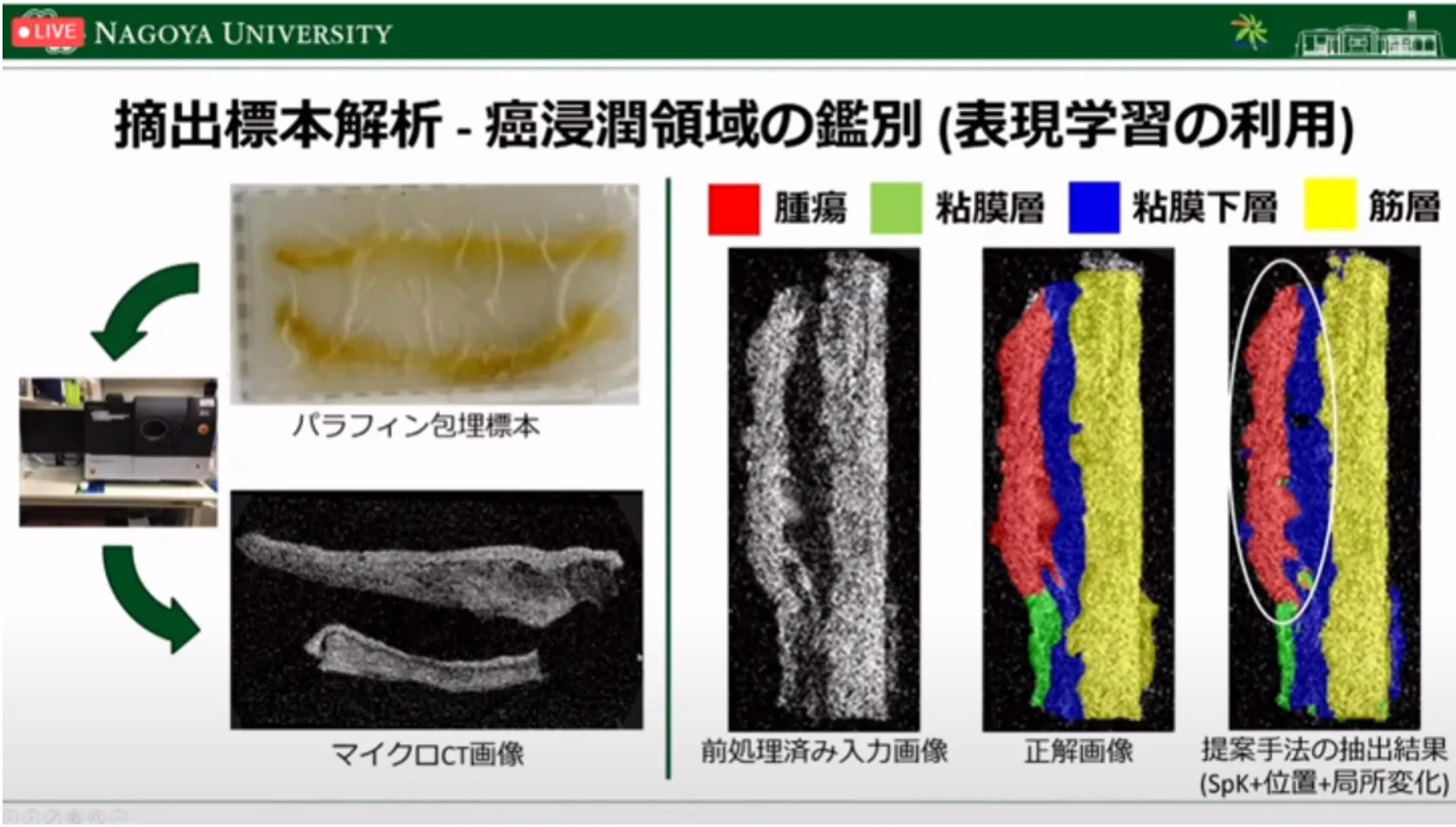 胃がん診断・治療のすべての段階でAI利活用の可能性を探る!名古屋大学大学院・森健策教授による最新研究の紹介(第94回日本胃癌学会総会)