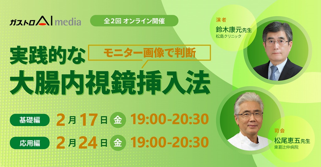 モニター画像で判断、実践的な大腸内視鏡挿入法(全2回)