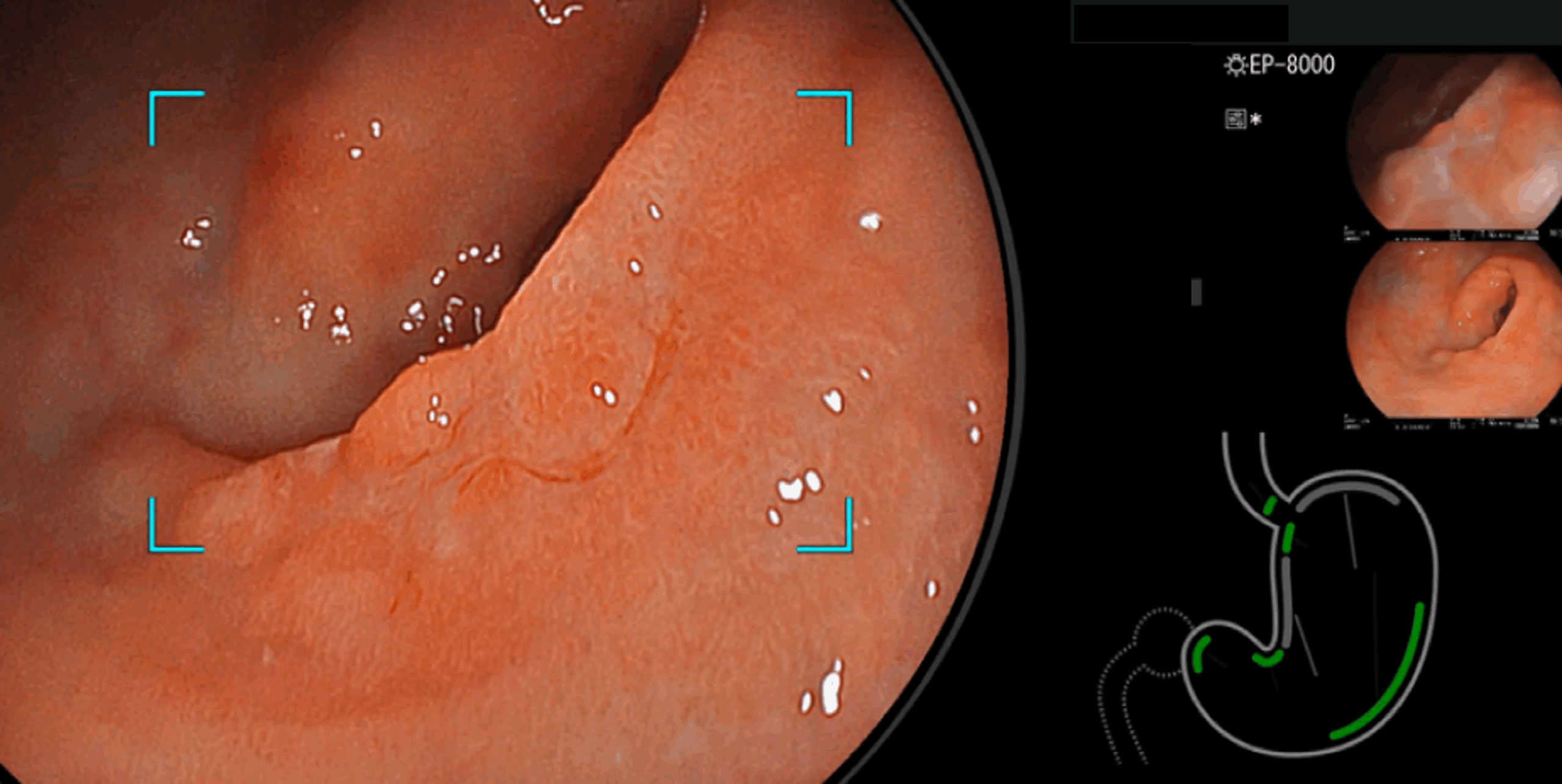 Column コラム一覧