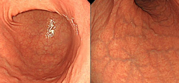 Column コラム一覧