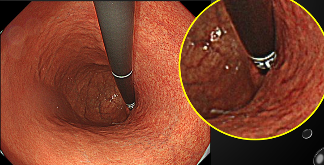 Column コラム一覧