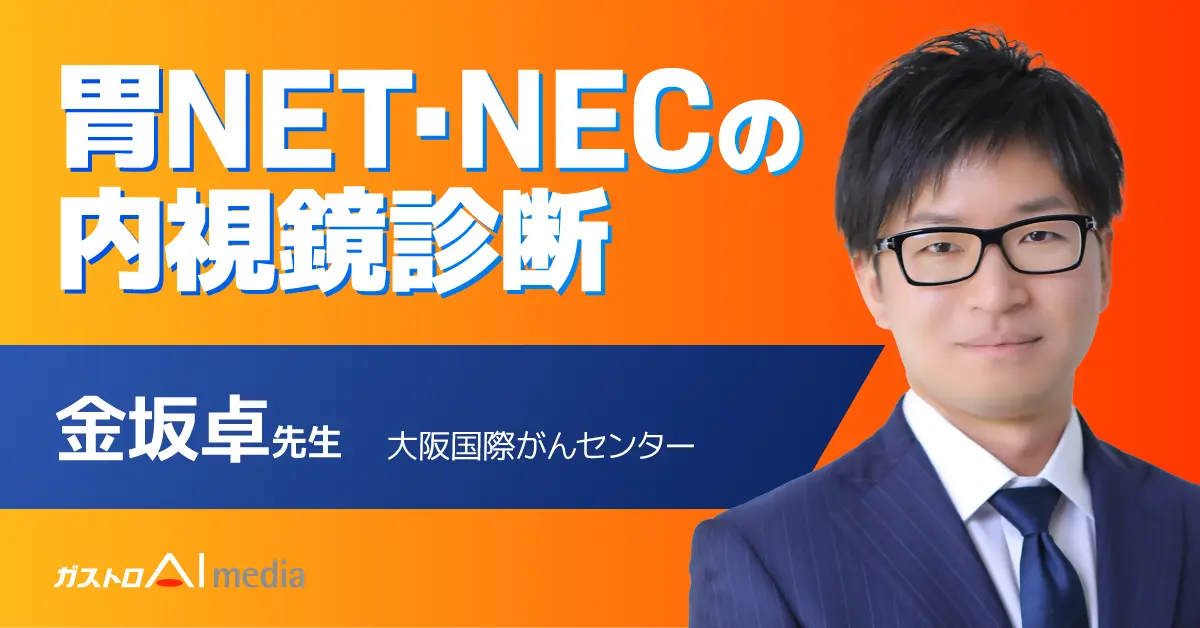 胃NET・NECの内視鏡所見、大阪国際がんセンターの症例で解説