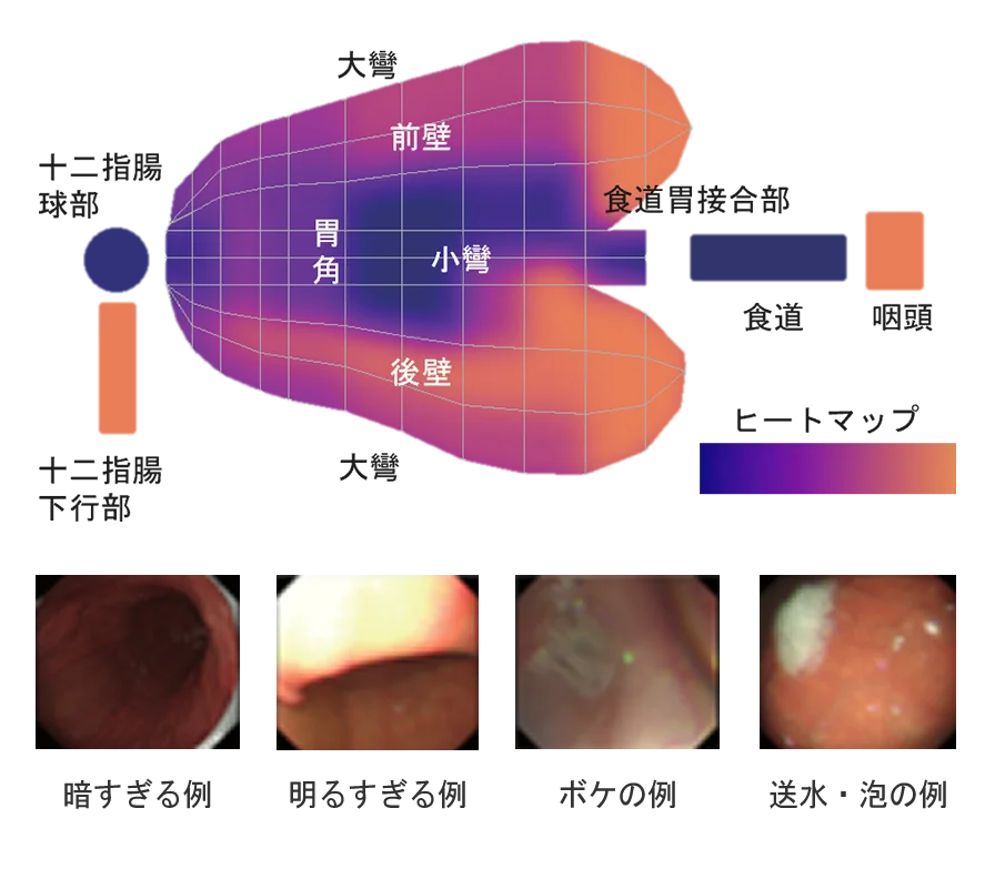 胃内視鏡網羅性評価 AI 