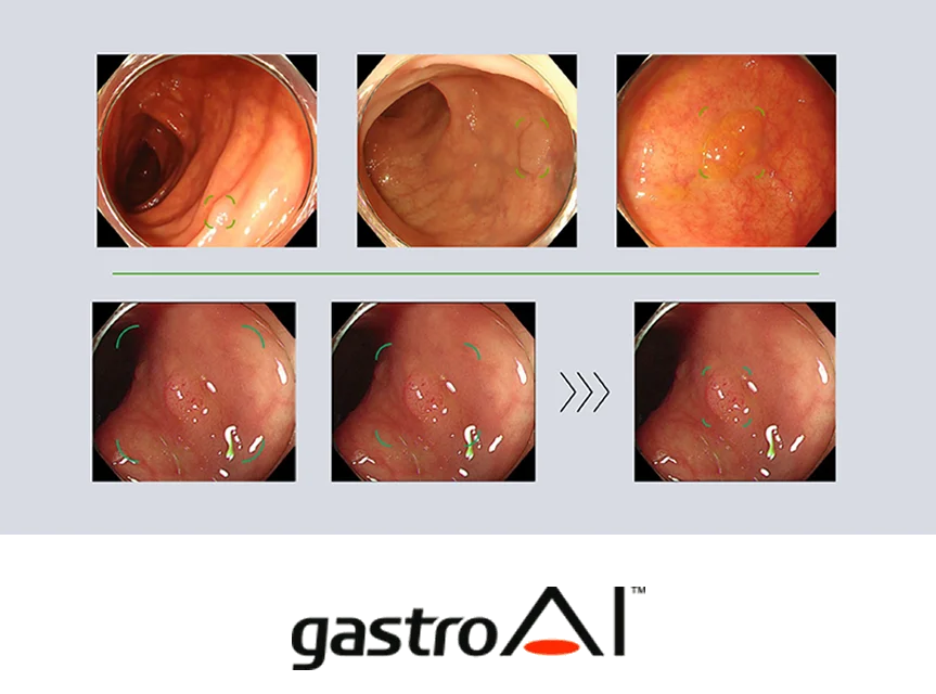 gastroAI model-EIRL