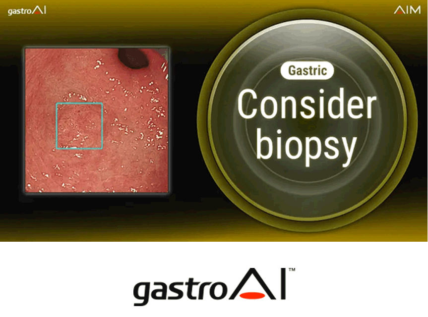 gastroAI model-G