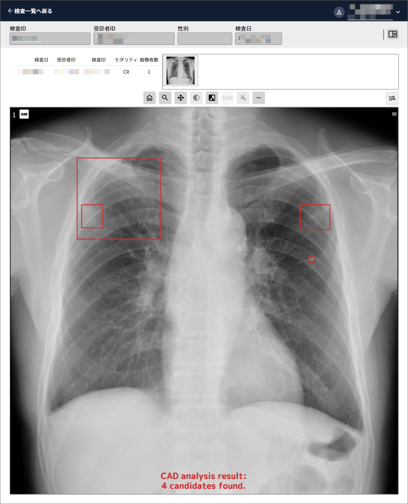 医用画像解析ソフトウェア EIRL Chest XR