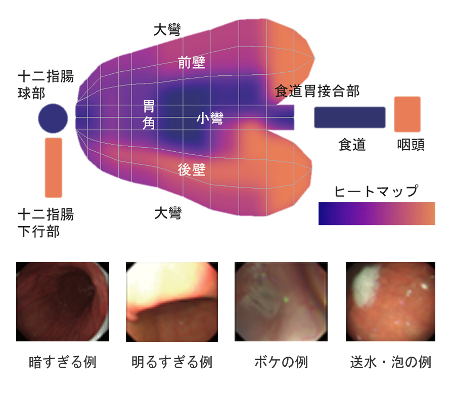 胃内視鏡網羅性評価 AI 